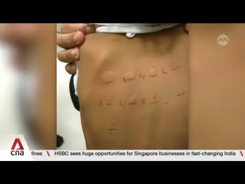 New national study on childhood food allergies in Singapore